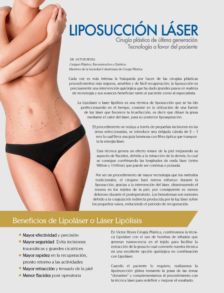 Beneficios de la Liposucción Láser - Dr. Víctor Reyes - Pereira Beneficios de la Liposucción Láser - Dr. Víctor Reyes - Pereira