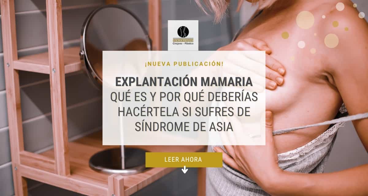 ☀ ¿Qué es una explantación mamaria? GUÍA COMPLETA PARA COLOMBIA