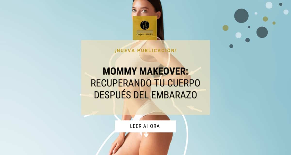 ☀ Mommy Makeover: Cómo recuperar tu figura post-embarazo