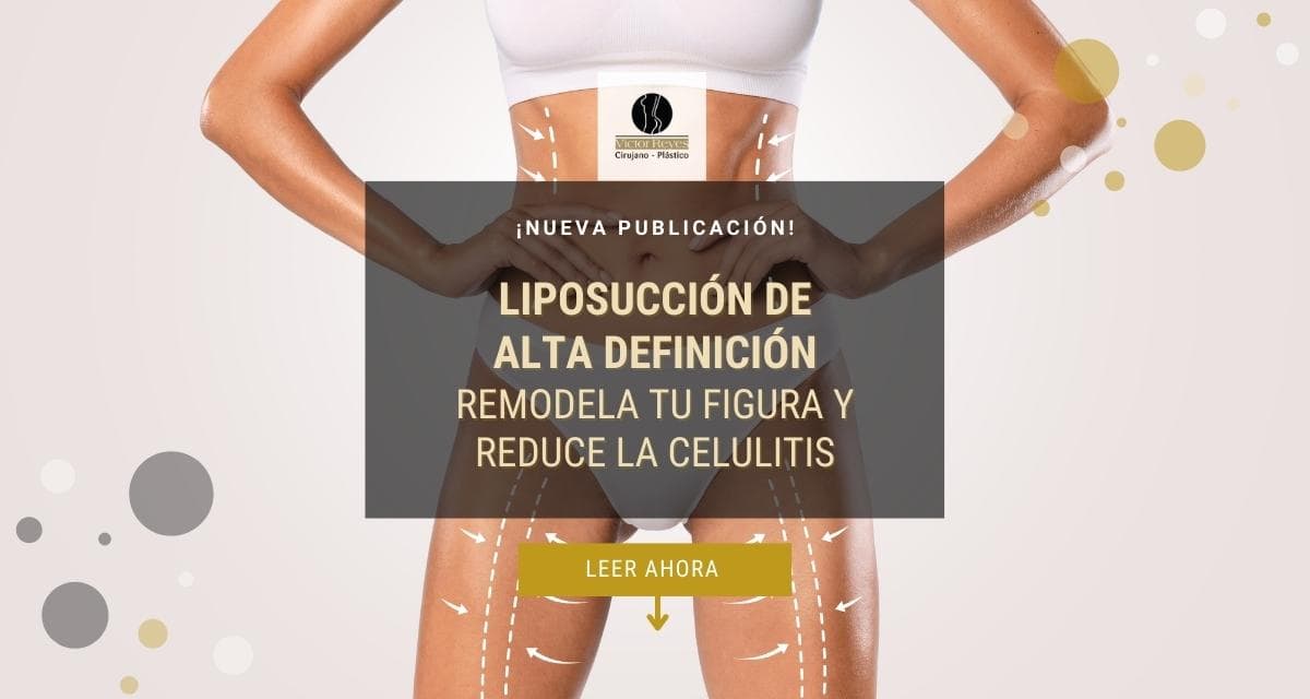 ☀ Liposucción de Alta Definición: Revolucionando la estética