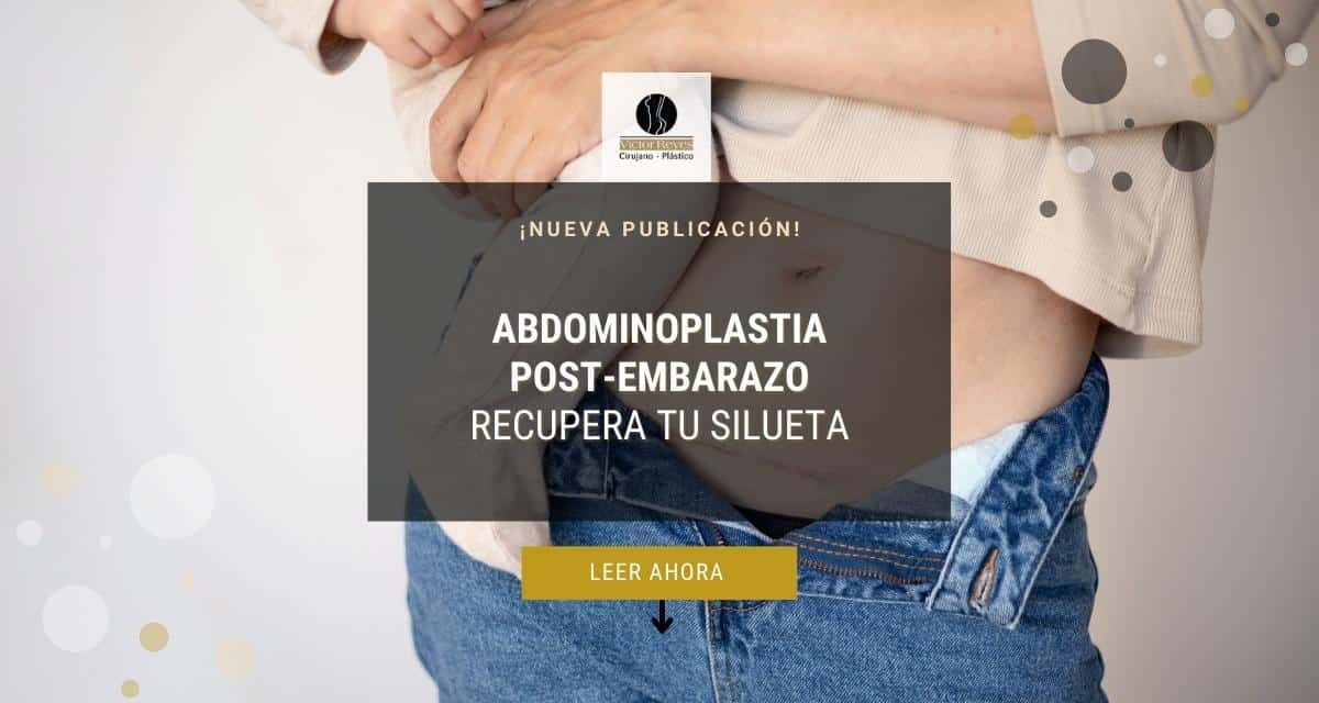☀ Abdominoplastia Post-Embarazo: Recupera tu silueta