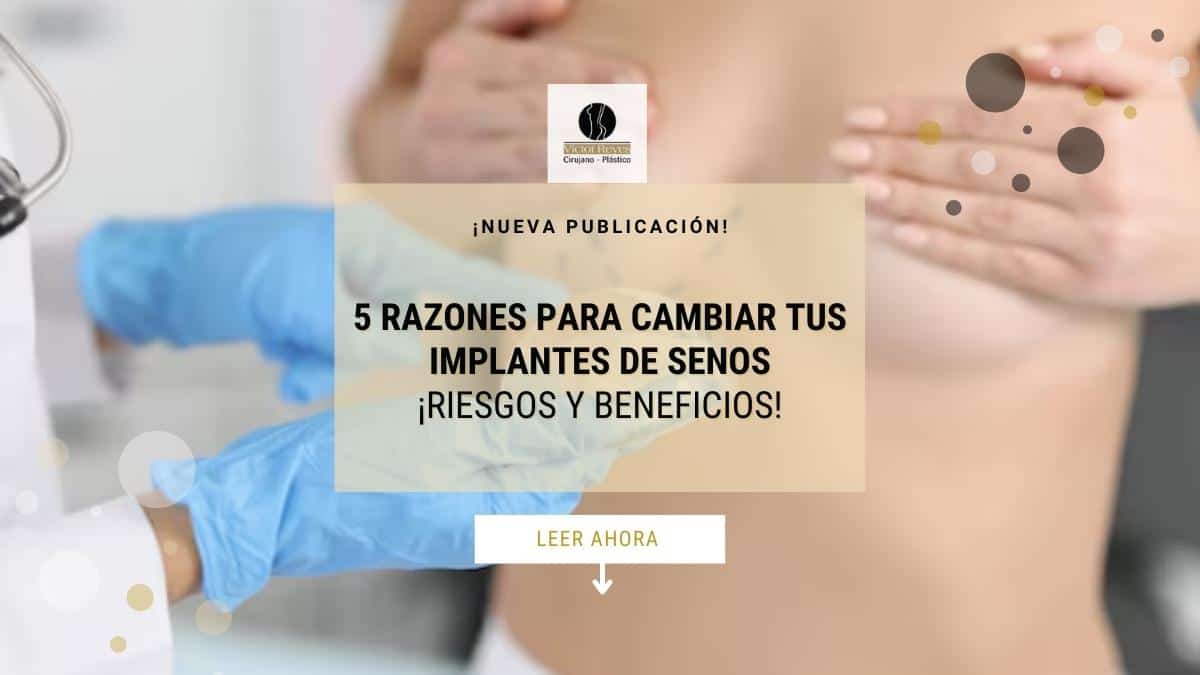 ¡CAMBIA tus implantes de senos! 5 motivos mayores para ello