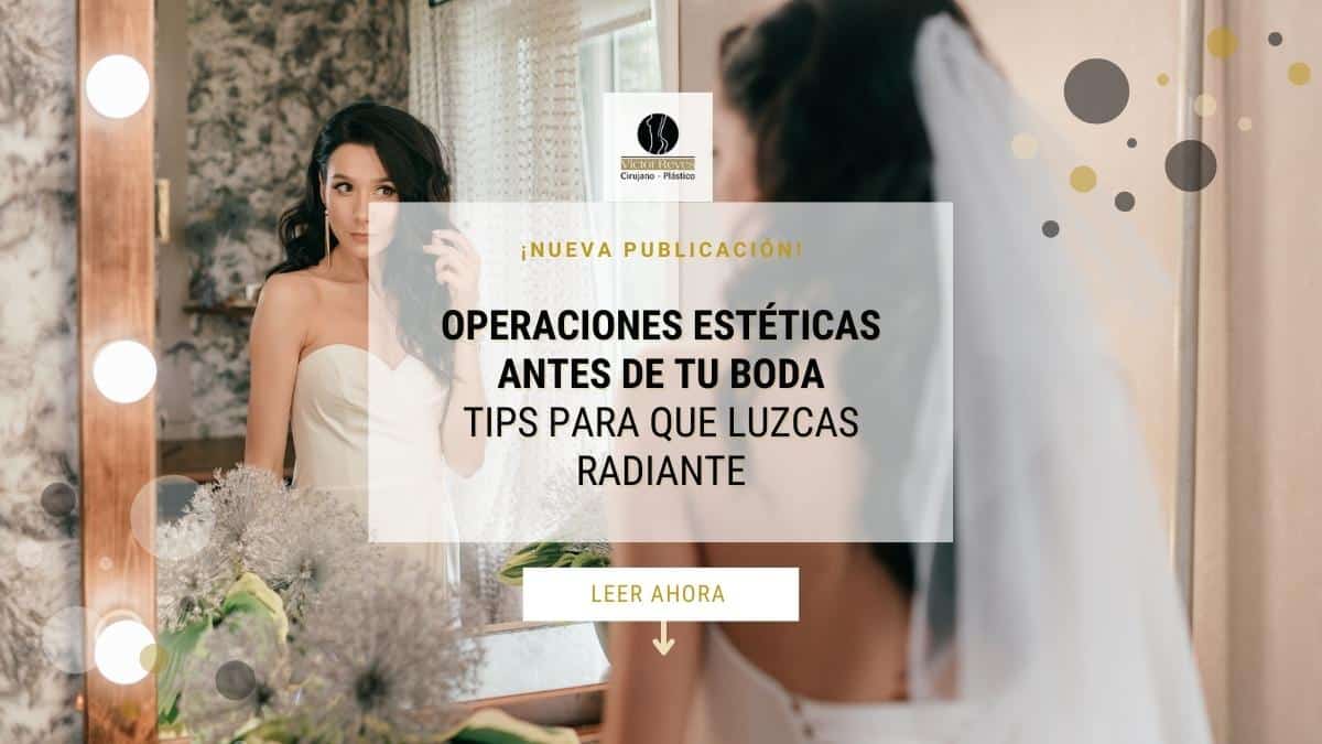 Opciones de Cirugía Plástica antes de TU BODA: Consejos