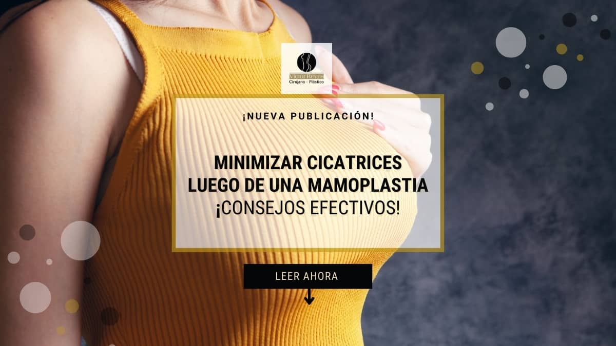 ✅ Cómo MINIMIZAR CICATRICES luego de una mamoplastia