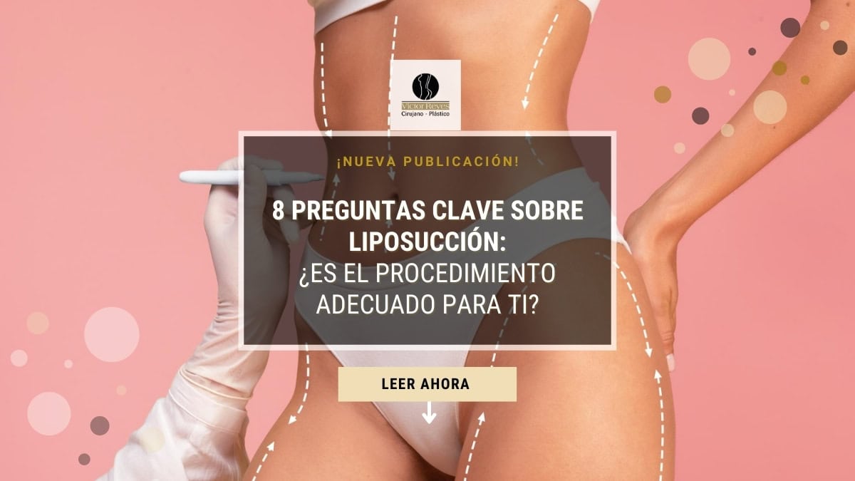 ► Liposucción en Colombia: 8 Preguntas Esenciales