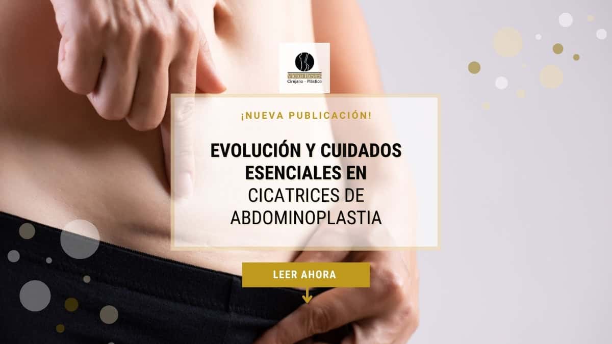 Evolución y Cuidados Esenciales en Cicatrices de Abdominoplastia