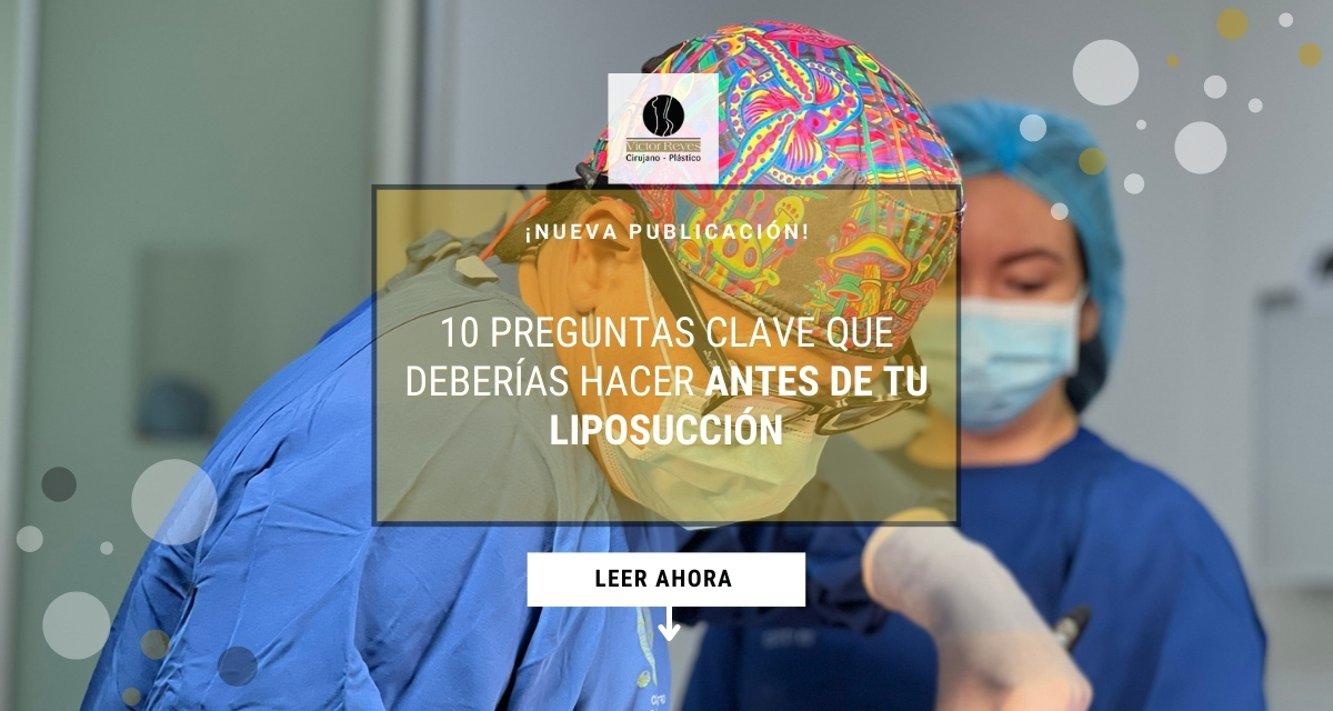 10 preguntas clave que deberías hacer antes de tu liposucción