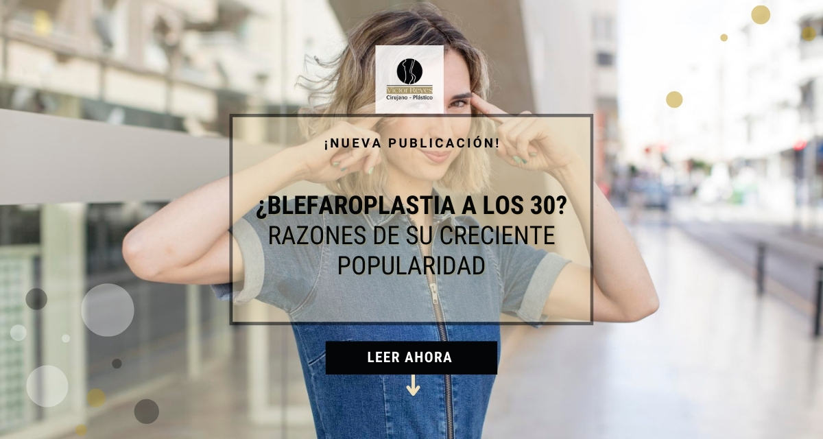 ¿Blefaroplastia a los 30? Razones de su creciente popularidad