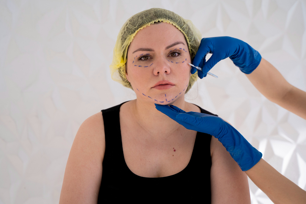 lipoinyección-facial (Relleno natural biológico en el rostro) en Pereira
